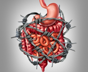 Dispepsia Funcional