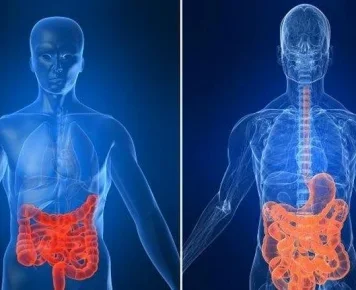 Manifesta&ccedil;&otilde;es Extraintestinais na Retocolite Ulcerativa e Doen&ccedil;a de Crohn